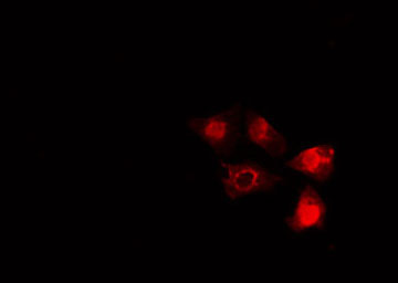 SMAD5 Antibody - Staining HeLa cells by IF/ICC. The samples were fixed with PFA and permeabilized in 0.1% Triton X-100, then blocked in 10% serum for 45 min at 25°C. The primary antibody was diluted at 1:200 and incubated with the sample for 1 hour at 37°C. An Alexa Fluor 594 conjugated goat anti-rabbit IgG (H+L) antibody, diluted at 1/600, was used as secondary antibody.