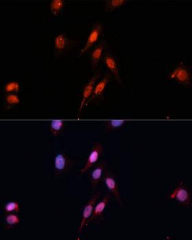 SMAD5 Antibody - Immunofluorescence analysis of HeLa cells using Smad5 Polyclonal Antibody at dilution of 1:100 (40x lens).Blue: DAPI for nuclear staining.