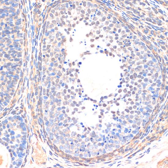 SMAD5 Antibody - Immunohistochemistry of paraffin-embedded Rat ovary using Smad5 Polyclonal Antibody at dilution of 1:200 (40x lens).