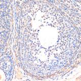 SMAD5 Antibody - Immunohistochemistry of paraffin-embedded Rat ovary using Smad5 Polyclonal Antibody at dilution of 1:200 (40x lens).