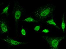 SMAD5 Antibody - Immunofluorescence staining of SMAD5 in HeLa cells. Cells were fixed with 4% PFA, permeabilzed with 0.3% Triton X-100 in PBS, blocked with 10% serum, and incubated with rabbit anti-human SMAD5 polyclonal antibody (dilution ratio 1:5000) at 4°C overnight. Then cells were stained with the Alexa Fluor 488-conjugated Goat Anti-rabbit IgG secondary antibody (green). Positive staining was localized to cytoplasm and nucleus.
