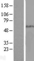 SMAD5 Protein - Western validation with an anti-DDK antibody * L: Control HEK293 lysate R: Over-expression lysate