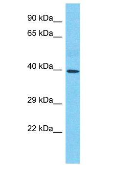 SMAD6 Antibody - SMAD6 antibody Western Blot of Thymus Tumor. Antibody dilution: 1 ug/ml.  This image was taken for the unconjugated form of this product. Other forms have not been tested.