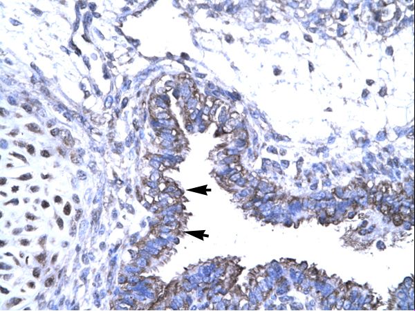 SMAD6 Antibody - SMAD6 antibody ARP32690_T100-NP_005576-SMAD6 (SMAD family member 6) Antibody was used in IHC to stain formalin-fixed, paraffin-embedded human lung.  This image was taken for the unconjugated form of this product. Other forms have not been tested.