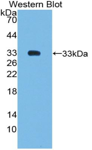 SMAD6 Antibody - Western blot of recombinant SMAD6.
