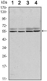 SMAD6 Antibody - SMAD6 Antibody in Western Blot (WB)