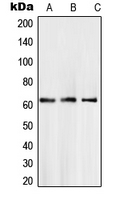 SMAD6 Antibody - Western blot analysis of SMAD6 expression in A204 (A); LN18 (B); L929 (C) whole cell lysates.