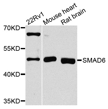 SMAD6 Antibody - Western blot analysis of extracts of various cell lines, using SMAD6 antibody at 1:1000 dilution. The secondary antibody used was an HRP Goat Anti-Rabbit IgG (H+L) at 1:10000 dilution. Lysates were loaded 25ug per lane and 3% nonfat dry milk in TBST was used for blocking. An ECL Kit was used for detection and the exposure time was 15s.