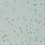 SMAD6 Antibody - Immunohistochemistry of paraffin-embedded rat brain using SMAD6 antibody at dilution of 1:100 (40x lens).
