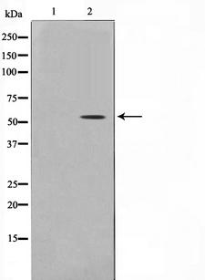 SMAD6 Antibody - Western blot analysis of Smad 6 expression in mouse brain. The lane on the left is treated with the antigen-specific peptide.
