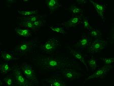 SMAD6 Antibody - Immunofluorescence staining of SMAD6 in A549 cells. Cells were fixed with 4% PFA, permeabilzed with 0.3% Triton X-100 in PBS, blocked with 10% serum, and incubated with rabbit anti-Human SMAD6 polyclonal antibody (dilution ratio 1:200) at 4°C overnight. Then cells were stained with the Alexa Fluor 488-conjugated Goat Anti-rabbit IgG secondary antibody (green). Positive staining was localized to Nucleus and Cytoplasm.