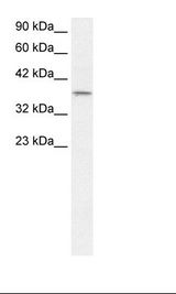 SMAD7 Antibody - Fetal Lung Lysate.  This image was taken for the unconjugated form of this product. Other forms have not been tested.