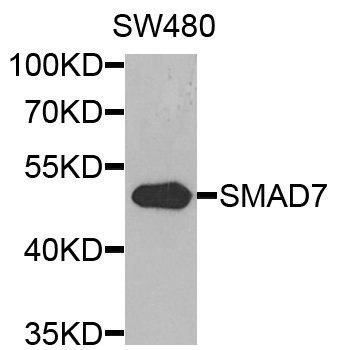 SMAD7 Antibody - Western blot analysis of extracts of SW480 cells, using SMAD7 antibody at 1:1000 dilution. The secondary antibody used was an HRP Goat Anti-Rabbit IgG (H+L) at 1:10000 dilution. Lysates were loaded 25ug per lane and 3% nonfat dry milk in TBST was used for blocking. An ECL Kit was used for detection and the exposure time was 10s.