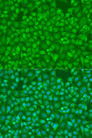SMAD7 Antibody - Immunofluorescence analysis of U2OS cells using SMAD7 antibodyat dilution of 1:100. Blue: DAPI for nuclear staining.