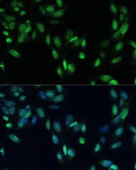 SMAD7 Antibody - Immunofluorescence analysis of U2OS cells using SMAD7 antibody at dilution of 1:100. Blue: DAPI for nuclear staining.