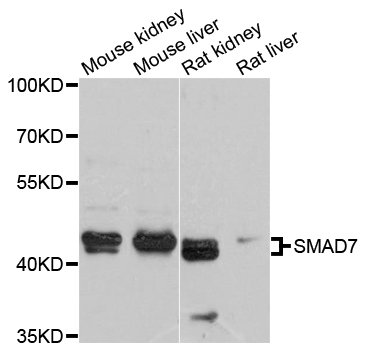 SMAD7 Antibody - Western blot analysis of extracts of various cell lines, using SMAD7 antibody at 1:1000 dilution. The secondary antibody used was an HRP Goat Anti-Rabbit IgG (H+L) at 1:10000 dilution. Lysates were loaded 25ug per lane and 3% nonfat dry milk in TBST was used for blocking. An ECL Kit was used for detection and the exposure time was 90s.