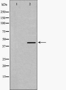 SMAD7 Antibody - Western blot analysis of Smad7 expression in human Kidney lysate. The lane on the left is treated with the antigen-specific peptide.