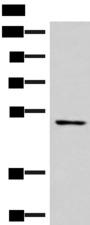 SMAD7 Antibody - Western blot analysis of Mouse heart tissue lysate  using SMAD7 Polyclonal Antibody at dilution of 1:900