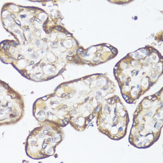 SMAD7 Antibody - Immunohistochemistry of paraffin-embedded Human placenta using SMAD7 Polyclonal Antibody at dilution of 1:100 (40x lens).