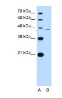 SMAD7 Antibody - Lane A: Marker. Lane B: Jurkat cell lysate. Antibody concentration: 1.25 ug/ml. Gel concentration: 12%.  This image was taken for the unconjugated form of this product. Other forms have not been tested.