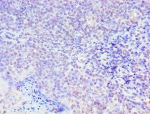 SMAD9 Antibody - Immunohistochemistry of paraffin-embedded human tonsil using antibody at 1:100 dilution.