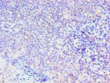 SMAD9 Antibody - Immunohistochemistry of paraffin-embedded human tonsil using antibody at 1:100 dilution.