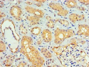 SMAD9 Antibody - Immunohistochemistry of paraffin-embedded human kidney using antibody at 1:100 dilution.