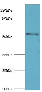 SMAD9 Antibody - Western blot. All lanes: Mothers against decapentaplegic homolog 9 antibody at 2 ug/ml+293T whole cell lysate. Secondary antibody: Goat polyclonal to rabbit at 1:10000 dilution. Predicted band size: 52 kDa. Observed band size: 52 kDa Immunohistochemistry.