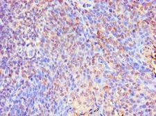 SMAD9 Antibody - Immunohistochemistry of paraffin-embedded human tonsil using antibody at 1:100 dilution.