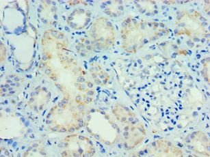 SMAD9 Antibody - Immunohistochemistry of paraffin-embedded kidney tonsil using antibody at 1:100 dilution.