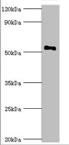 SMAD9 Antibody - Western blot All lanes: Mothers against decapentaplegic homolog 9 antibody at 2µg/ml + 293T whole cell lysate Secondary Goat polyclonal to rabbit IgG at 1/10000 dilution Predicted band size: 53, 49 kDa Observed band size: 53 kDa