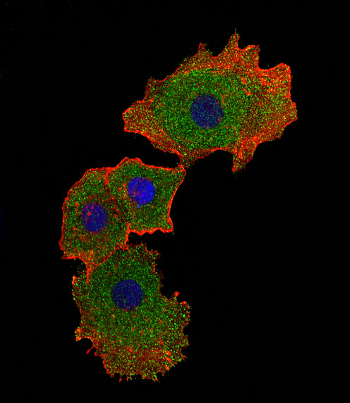 SMAD9 Antibody - Fluorescent confocal image of MCF-7 cell stained with SMAD9 Antibody. MCF-7 cells were fixed with 4% PFA (20 min), permeabilized with Triton X-100 (0.1%, 10 min), then incubated with SMAD9 primary antibody (1:25, 1 h at 37°C). For secondary antibody, Alexa Fluor 488 conjugated donkey anti-rabbit antibody (green) was used (1:400, 50 min at 37°C). Cytoplasmic actin was counterstained with Alexa Fluor 555 (red) conjugated Phalloidin (7units/ml, 1 h at 37°C). Nuclei were counterstained with DAPI (blue) (10 ug/ml, 10 min). SMAD9 immunoreactivity is localized to cytoplasm and nucleus significantly.