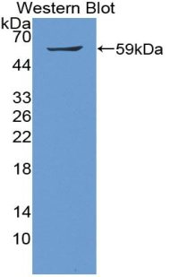 SMAD9 Antibody - Western blot of recombinant SMAD9.