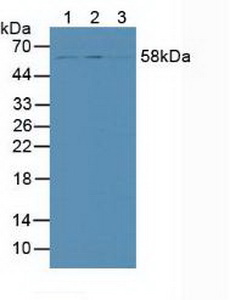 SMAD9 Antibody - Western Blot; Lane1: Human Hela Cells; Lane2: Human 293T Cells; Lane3: Human HepG2 Cells.