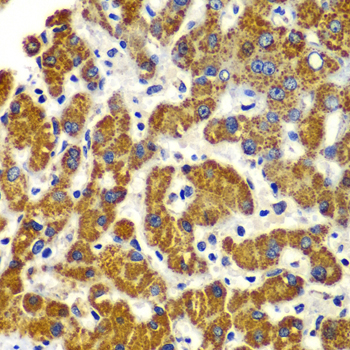SMAD9 Antibody - Immunohistochemistry of paraffin-embedded human liver injury tissue.