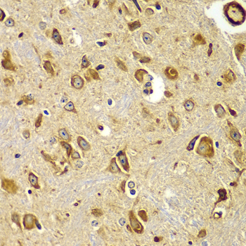 SMAD9 Antibody - Immunohistochemistry of paraffin-embedded mouse brain tissue.