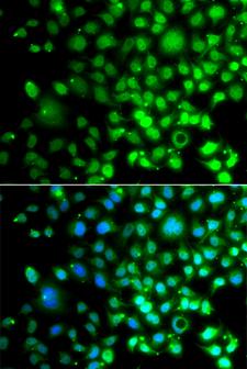 SMAD9 Antibody - Immunofluorescence analysis of A549 cells.