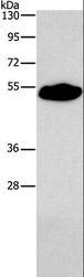 SMAD9 Antibody - Western blot analysis of Mouse heart tissue, using SMAD9 Polyclonal Antibody at dilution of 1:290.