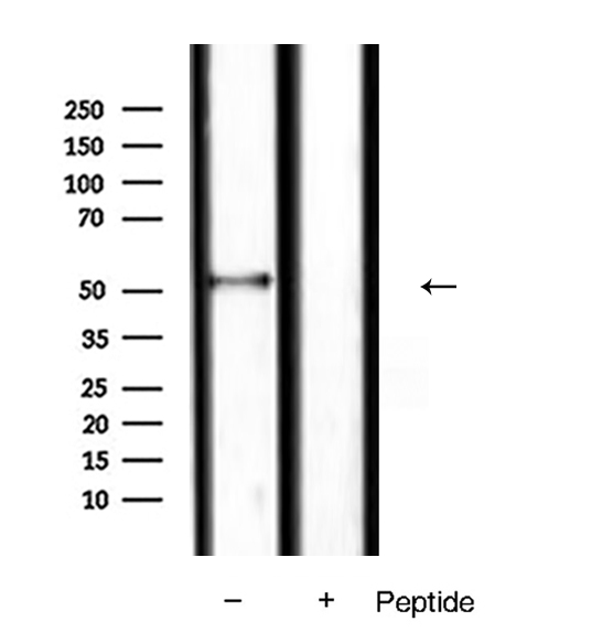 SMAD9 Antibody - Western blot analysis of extracts of mouse liver tissue using Smad9 antibody.