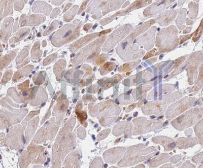 SMAD9 Antibody - IHC test Smad9 antibody in human skin tissue.