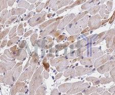 SMAD9 Antibody - IHC test Smad9 antibody in human skin tissue.