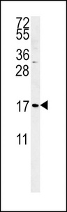 SMAGP Antibody - SMAGP Antibody western blot of K562 cell line lysates (35 ug/lane). The SMAGP antibody detected the SMAGP protein (arrow).