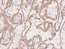 SMAGP Antibody - Immunochemical staining of human SMAGP in human placenta with rabbit polyclonal antibody at 1:1000 dilution, formalin-fixed paraffin embedded sections.