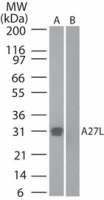 Smallpox-A27L Antibody - Western blot ofA27L in (A) recombinant fusion protein containing amino acids42-56 and (B) fusion partner without these amino acids, using antibody at 0.5 ug/ml.