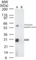 Smallpox-B5R Antibody - Western blot ofB5R in (A) recombinant fusion protein containing amino acids180-194 and (B) fusion partner without these amino acids, using antibody at 0.1 ug/ml.