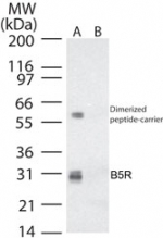 Smallpox-B5R Antibody - Western blot ofB5R in (A) recombinant fusion protein containing amino acids33-47 and (B) fusion partner without these amino acids, using antibody at 0.2 ug/ml.
