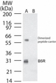 Smallpox-B5R Antibody - Western blot ofB5R in (A) recombinant fusion protein containing amino acids33-47 and (B) fusion partner without these amino acids, using antibody at 0.2 ug/ml.