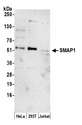 SMAP1 Antibody - Detection of human SMAP1 by western blot. Samples: Whole cell lysate (15 µg) from HeLa, HEK293T, and Jurkat cells prepared using NETN lysis buffer. Antibody: Affinity purified rabbit anti-SMAP1 antibody used for WB at 1:1000. Detection: Chemiluminescence with an exposure time of 3 minutes.