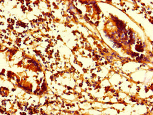 SMAP1 Antibody - Immunohistochemistry of paraffin-embedded human appendix tissue using SMAP1 Antibody at dilution of 1:100