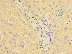 SMAP1 Antibody - Immunohistochemistry of paraffin-embedded human liver tissue using SMAP1 Antibody at dilution of 1:100